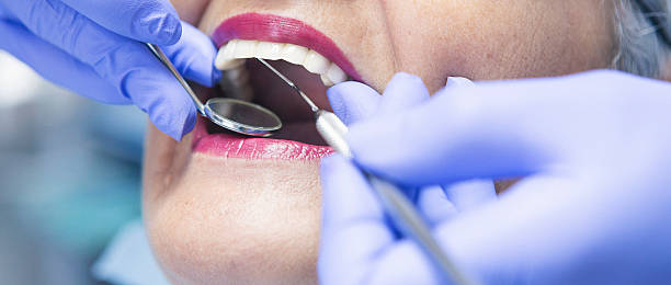 Best Emergency Dental Care for Broken or Chipped Teeth in Corry, PA